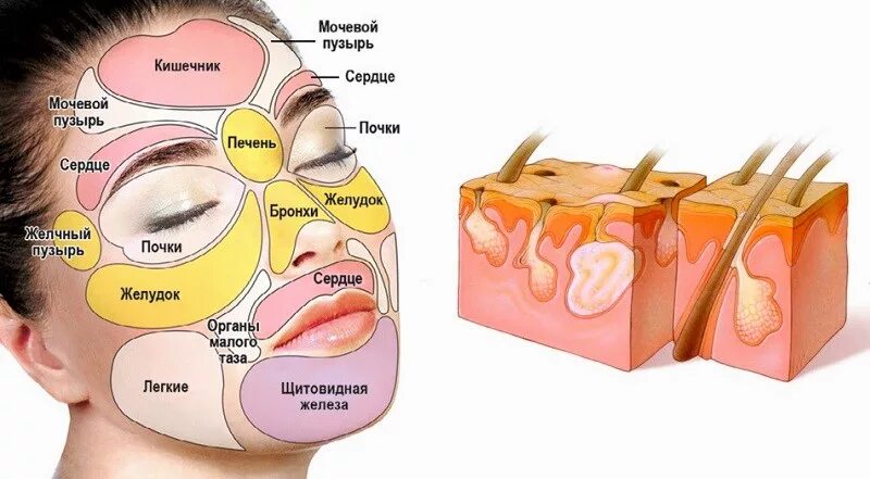 Возникнуть плотно. Внутренние подкожные прыщи на лице.