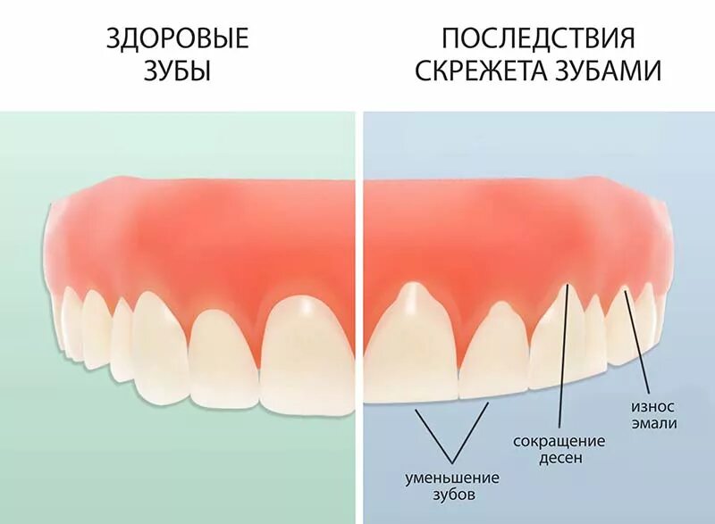 Почему зубы твердые