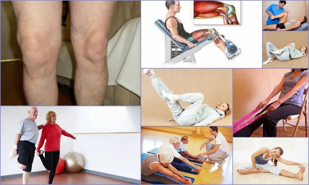 При артрозе суставов больше двигаться или лежать. Упражнения гонартроз. Гонартроз лечебная физкультура. Гонартроз коленного сустава ЛФК. Лечебная гимнастика при гонартрозе.
