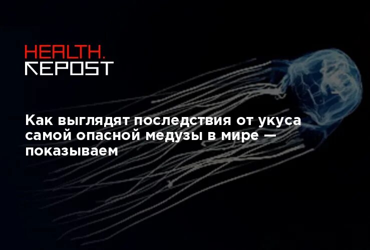 Как выглядит укус самой ядовитой медузы Что будет, если ужалит фиолетовый корнерот YouTube