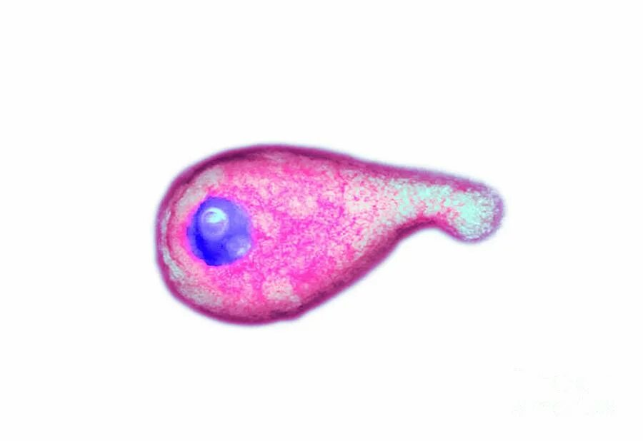 Chlamydia trachomatis mycoplasma genitalium. Микоплазмы гениталиум. Mycoplasma genitalium (микоплазма гениталиум. Микоплазма гениталиум 10^3.