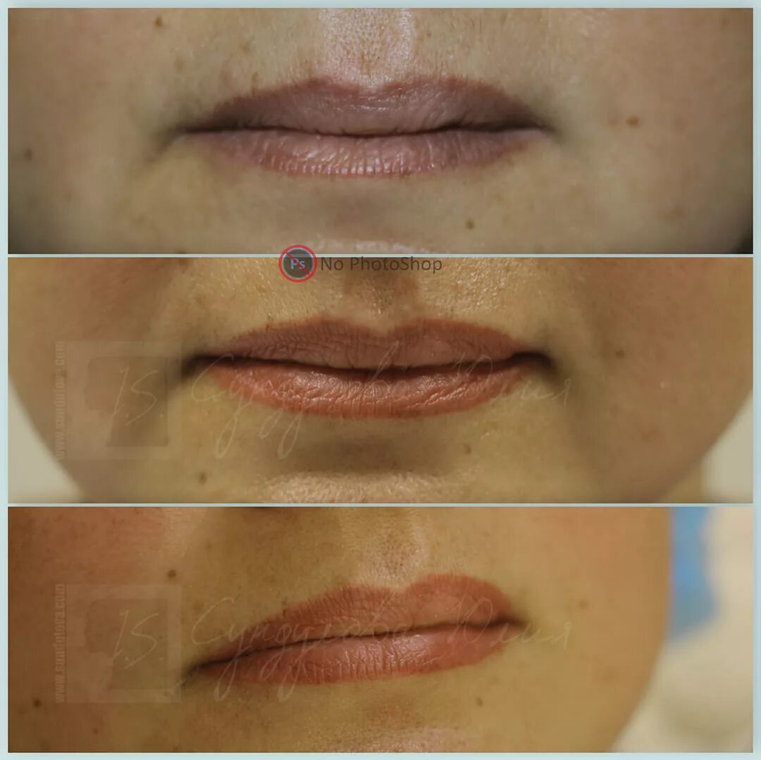 выцветший татуаж губ. как татуаж губ меняет внешность. рефрешинг губ гиалуроновой кислотой. пергамент губ до и после. перманент губ до и после.