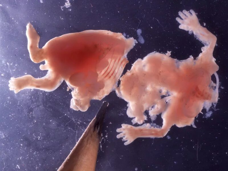 Человеческий эмбрион аборт. Человеческий зародыш выкидыш. 8 неделя заболела