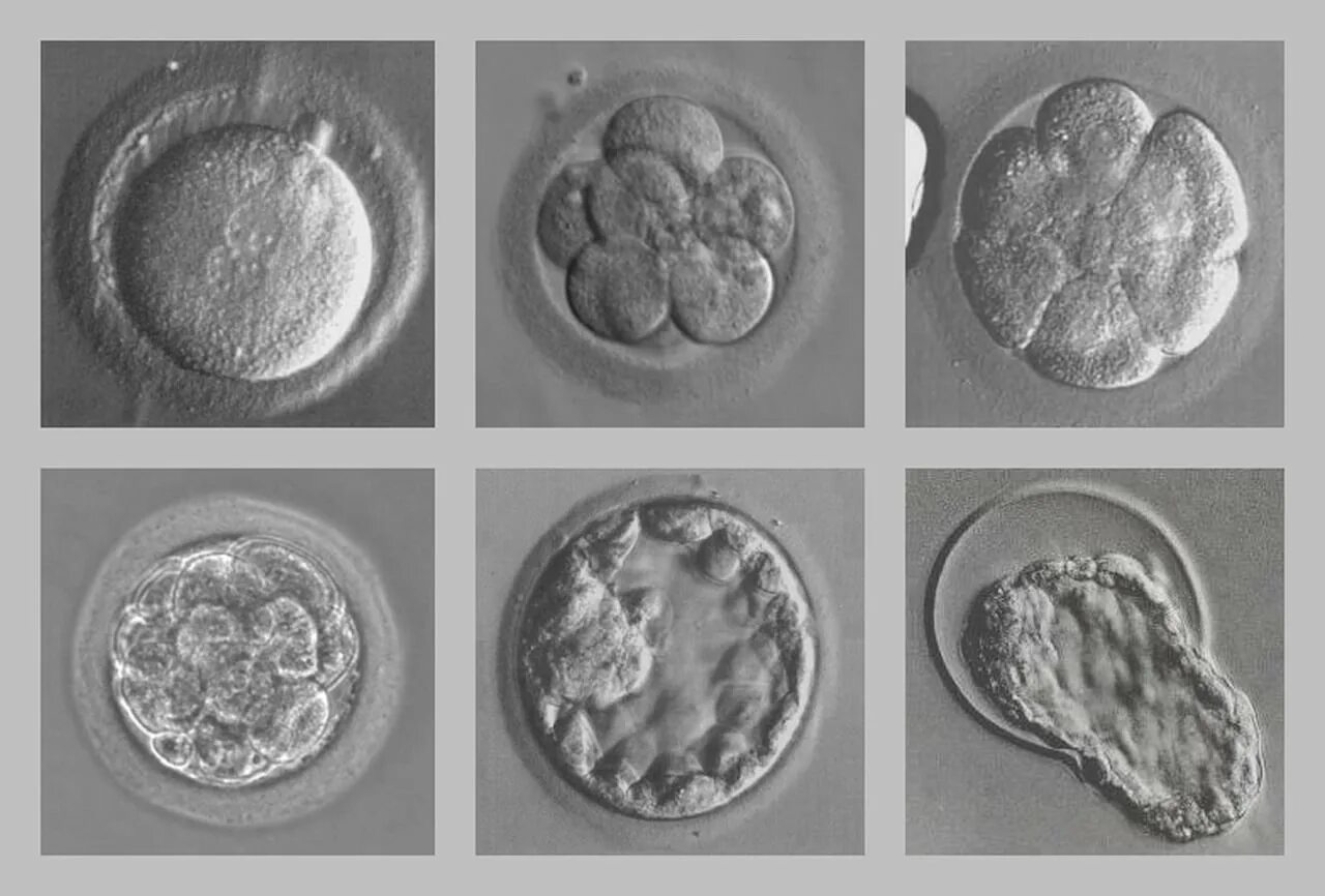 Сколько эмбрионов форум. Бластоциста на 5 день. Эко эмбрион морула. Эмбрион бластоциста. Бластоциста клеточный эмбрион.