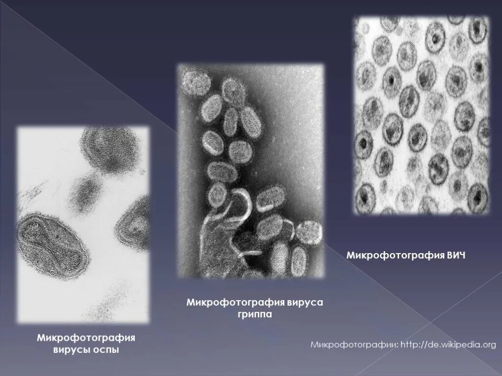 Микрофотографии вирусов. Вирус герпеса микроскопия. Вирус гриппа микрофотография. Вирус герпеса микрофотография. Вирус гриппа микрофотография.
