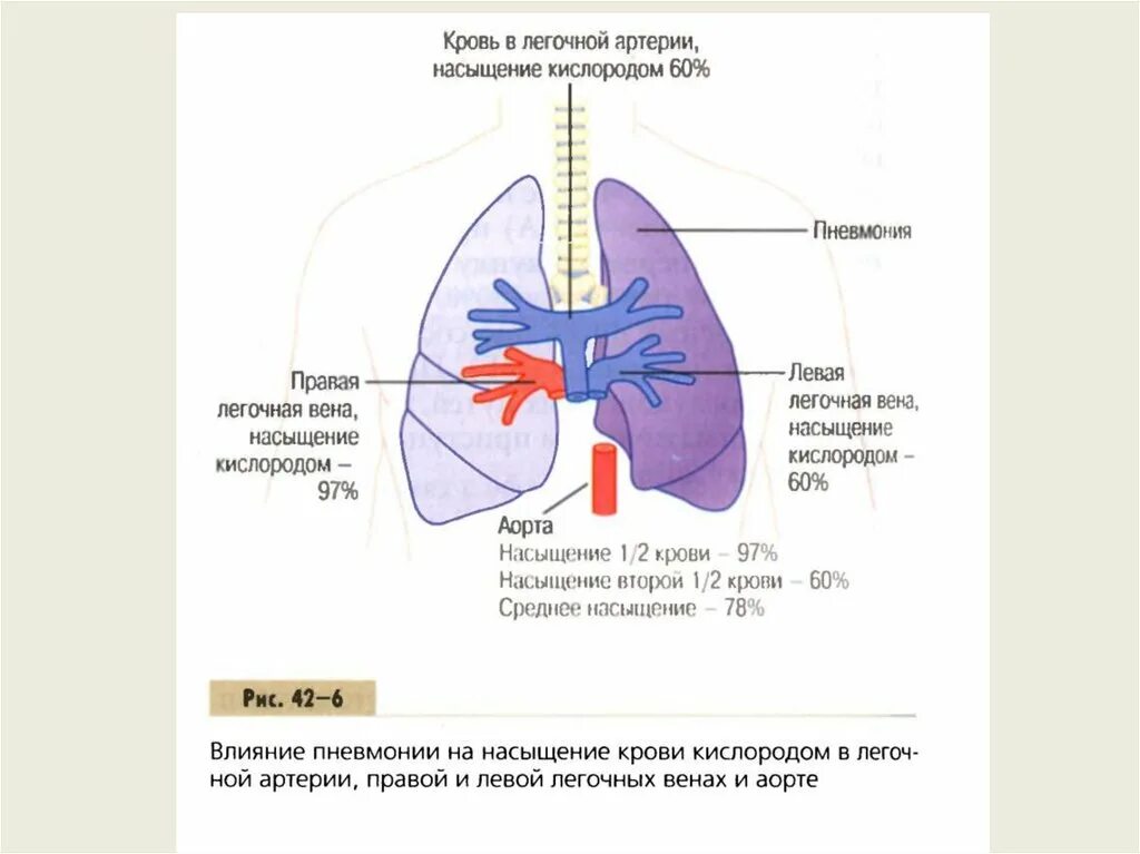 Обогащение легких кислородом. Насыщение легких кислородом. Схема насыщения крови кислородом у человека. Насыщение крови кислородом происходит в. Кровь насыщается кислородом в легких.