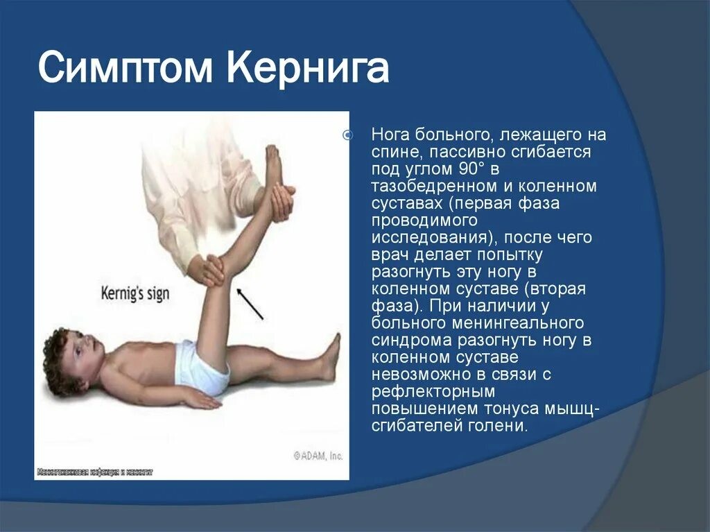 Рефлексы Кернига и Брудзинского. Симптом Кернига и Брудзинского. Менингеальный синдром симптом Кернига. Менингеальные рефлексы (Кернига, Брудзинского).