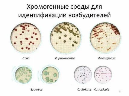 Селективно диагностические среды