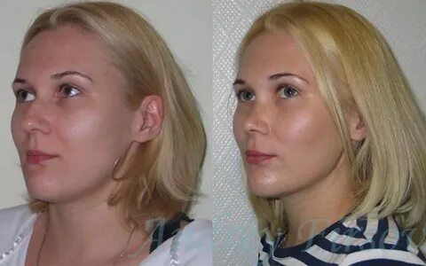Вакансия пластическая хирургия москва