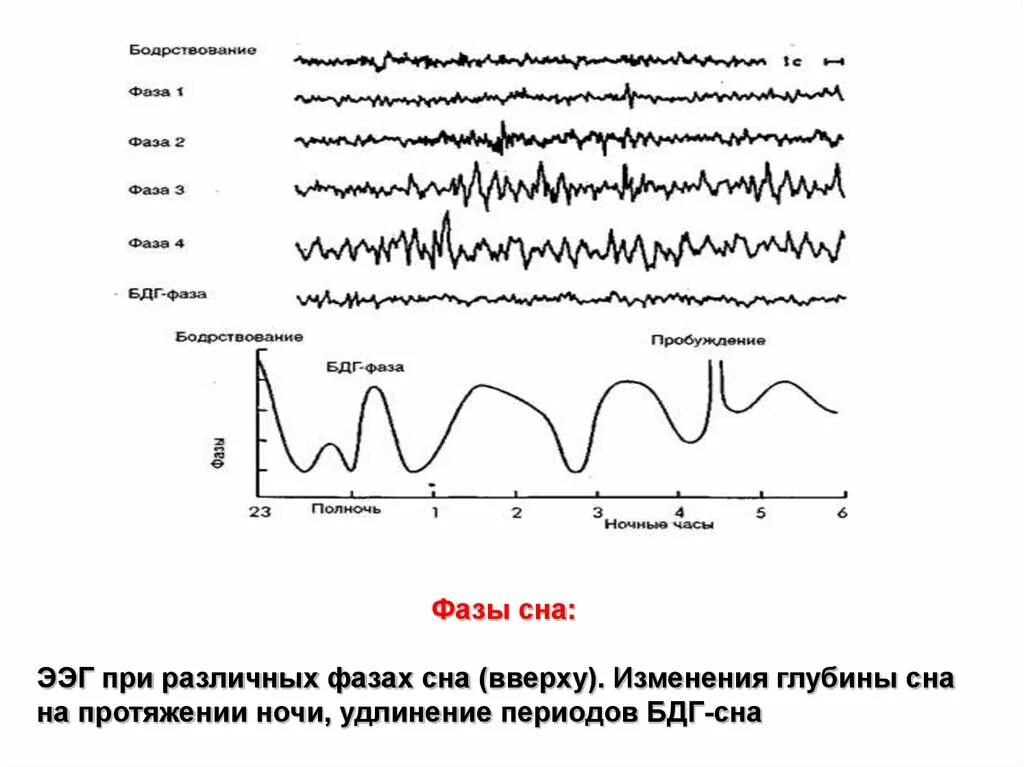 Фазы ээг. Ээг-корреляты фаз сна.. фазы сна показатели ээг. стадии сна на ээг. характеристика фаз сна на ээг.