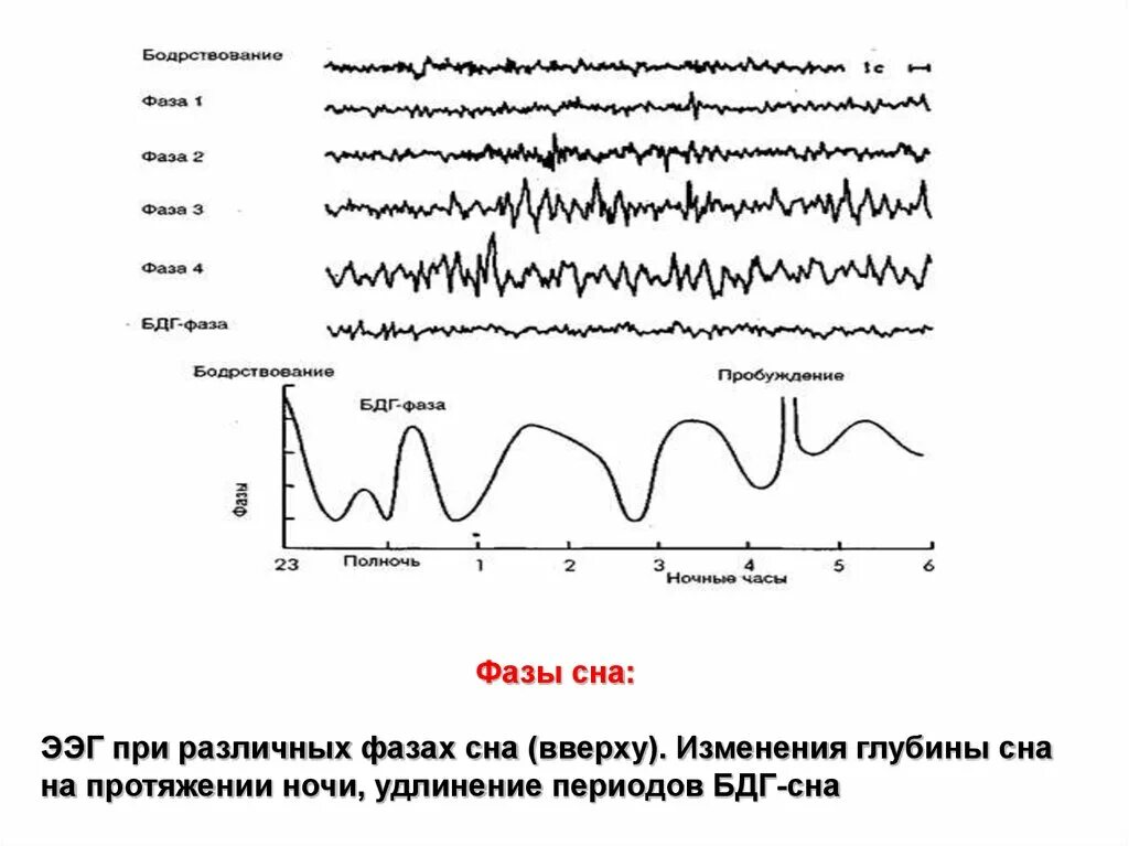 Ээг бодрствования. ЭЭГ-корреляты фаз сна.. Фазы сна на ЭЭГ. Характеристика фаз сна на ЭЭГ. Фазы медленного сна ЭЭГ.