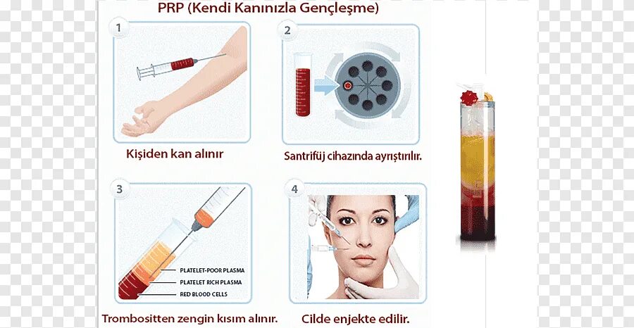 Плазма обогащенная тромбоцитами PRP. PRP терапия дерматология. Плазма крови в лицо