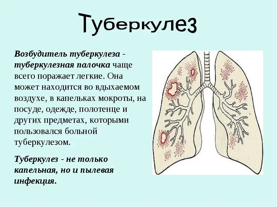 Ru туберкулез. Туберкулез название заболевания. Поражение органов туберкулезом.