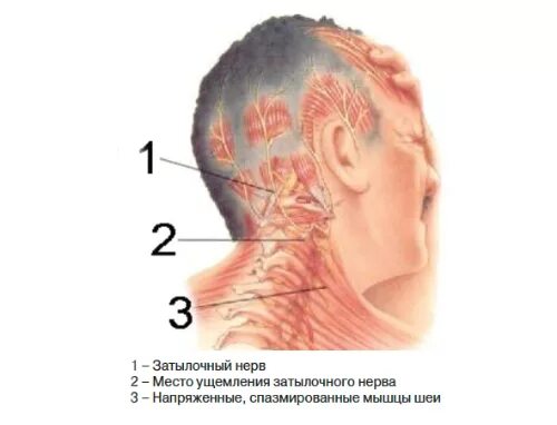 Левая часть затылка