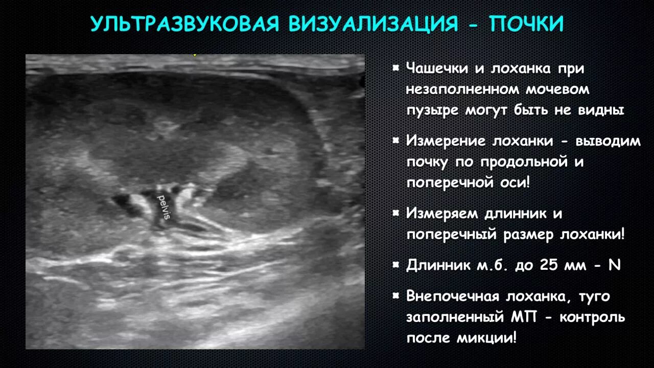 Узи лоханки почки. Измерение размеров почки на УЗИ. Измерение лоханки почки на УЗИ. Лоханка почки на УЗИ норма. Ширина почки на УЗИ.