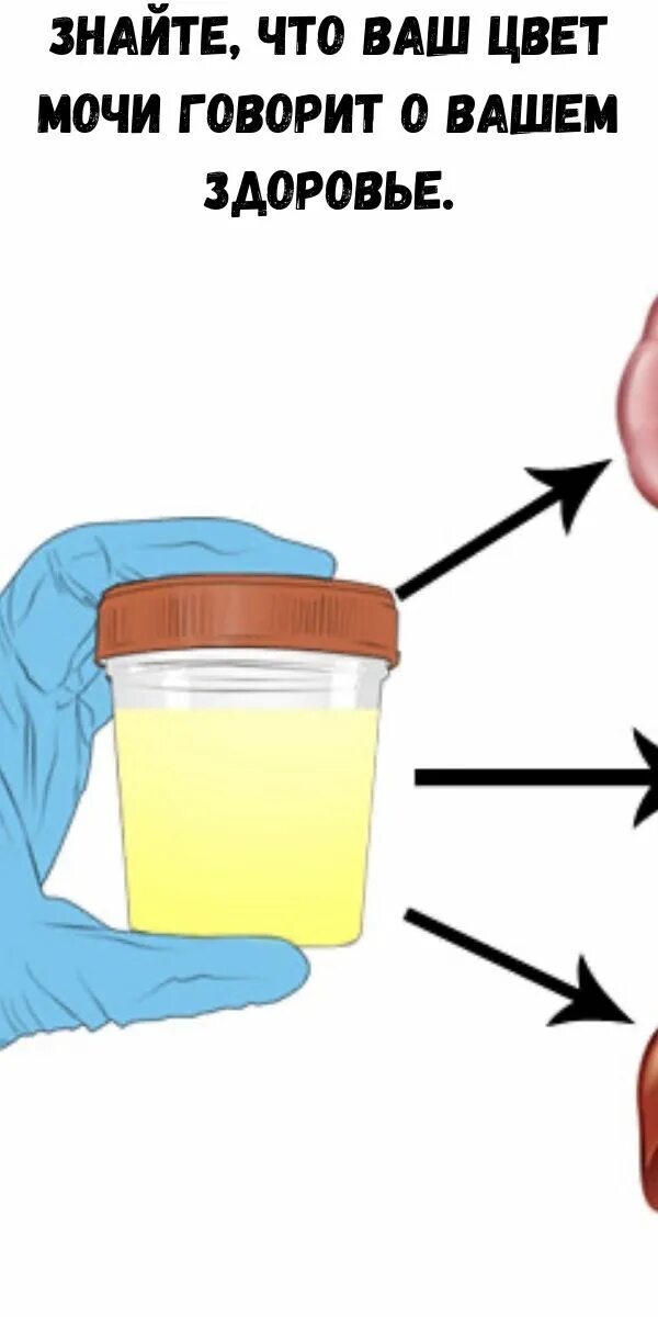 Моча сильно пенится. Цвет мочи. Цвет мочи и здоровье. Цвет мочи о чем говорит. Анализ мочи цвет.
