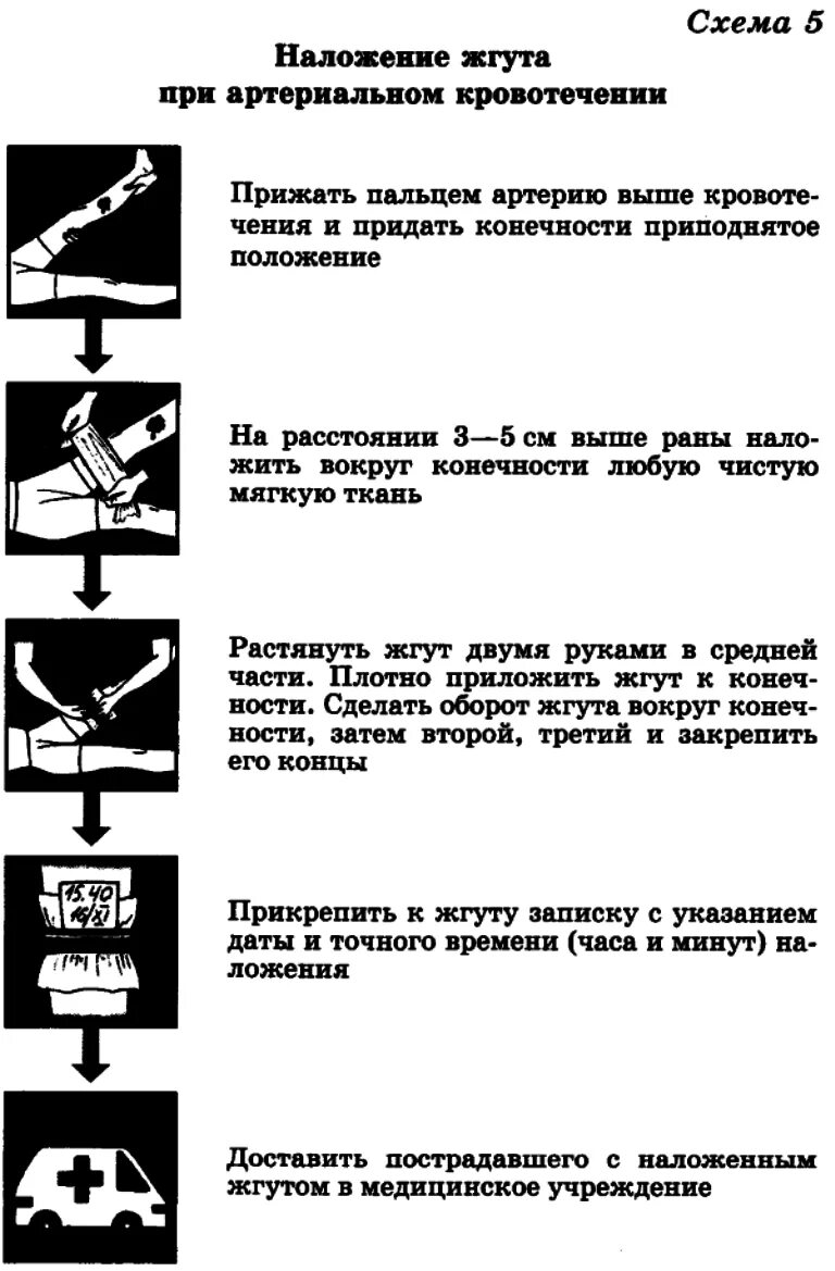 Схема наложения жгута при артериальном кровотечении. Наложение жгута при артериакровотечении.