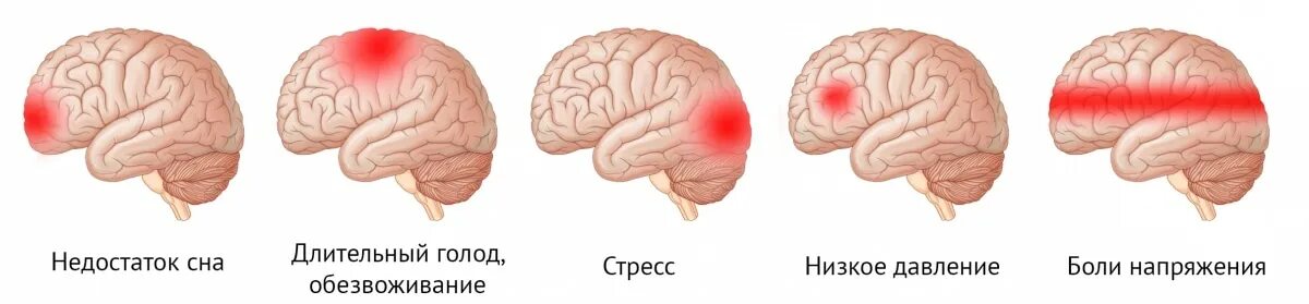 Ощущение давления в голове. Ощущение давления в голове