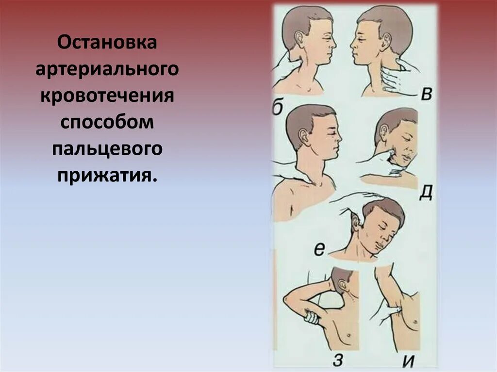 Какой способ остановки артериального кровотечения наиболее. Остановка артериального кров. Остановка артериального кровотечени. Остановить артериальное кровотечение. Порядок остановки артериального кровотечения кратко.