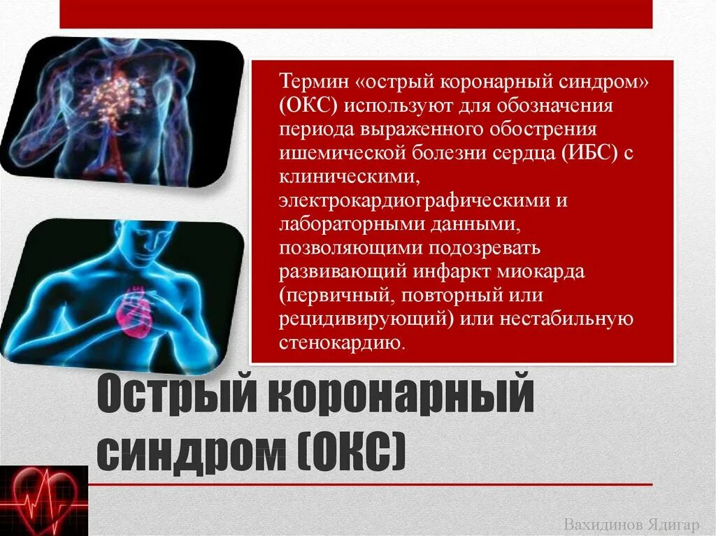 Диагноз окс