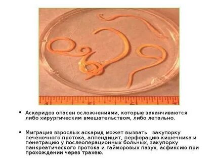 Что значит аскаридоз