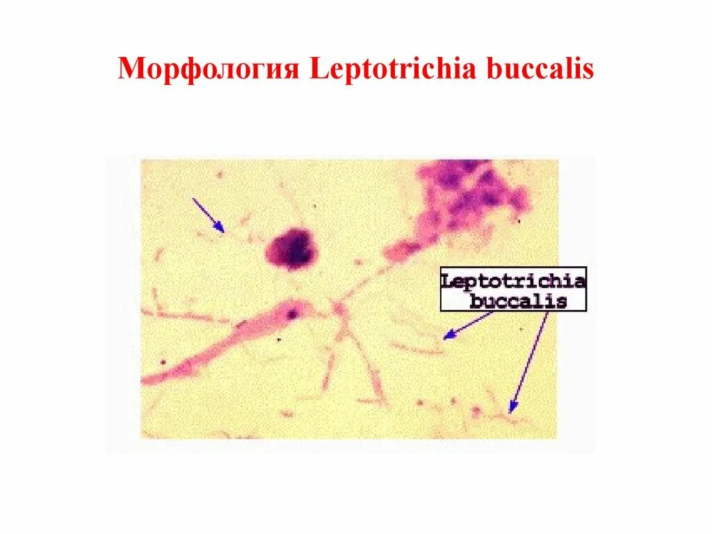 Лептотрикс лечение. Лептотрикс (Leptothrix). Leptothrix buccalis. Лептотрихии морфология. Лептотрихии микробиология.