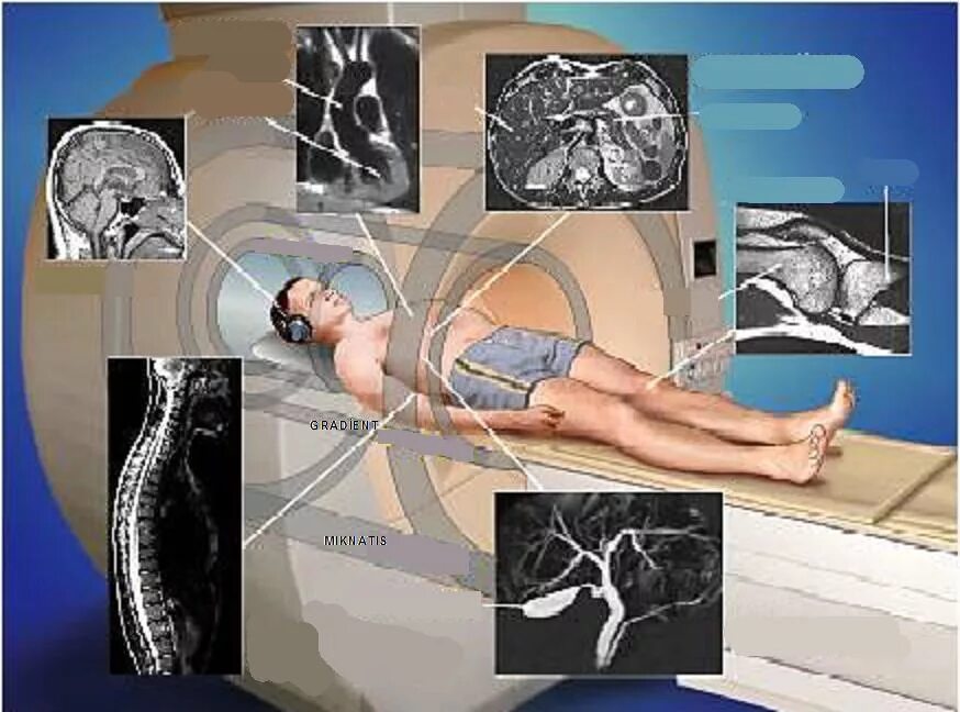 Делают ли мрт руки. Магнитно-резонансная томография принцип метода. Мрт. Метод компьютерной томографии. Кт и мрт.