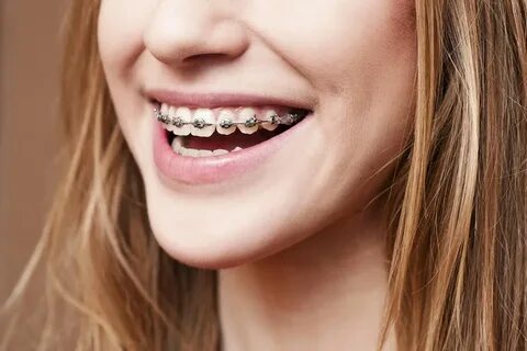 Bare teeth