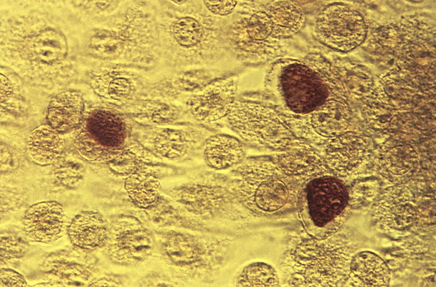 Хламидиоз 1. Хламидии возбудитель орнитоза\. Хламидия трахоматис под микроскопом. Хламидиоз трахоматис микроскоп. Венерическая лимфогранулема хламидии.