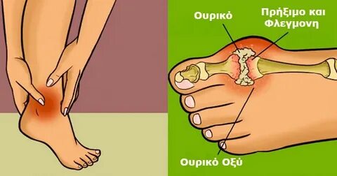 Uric acid