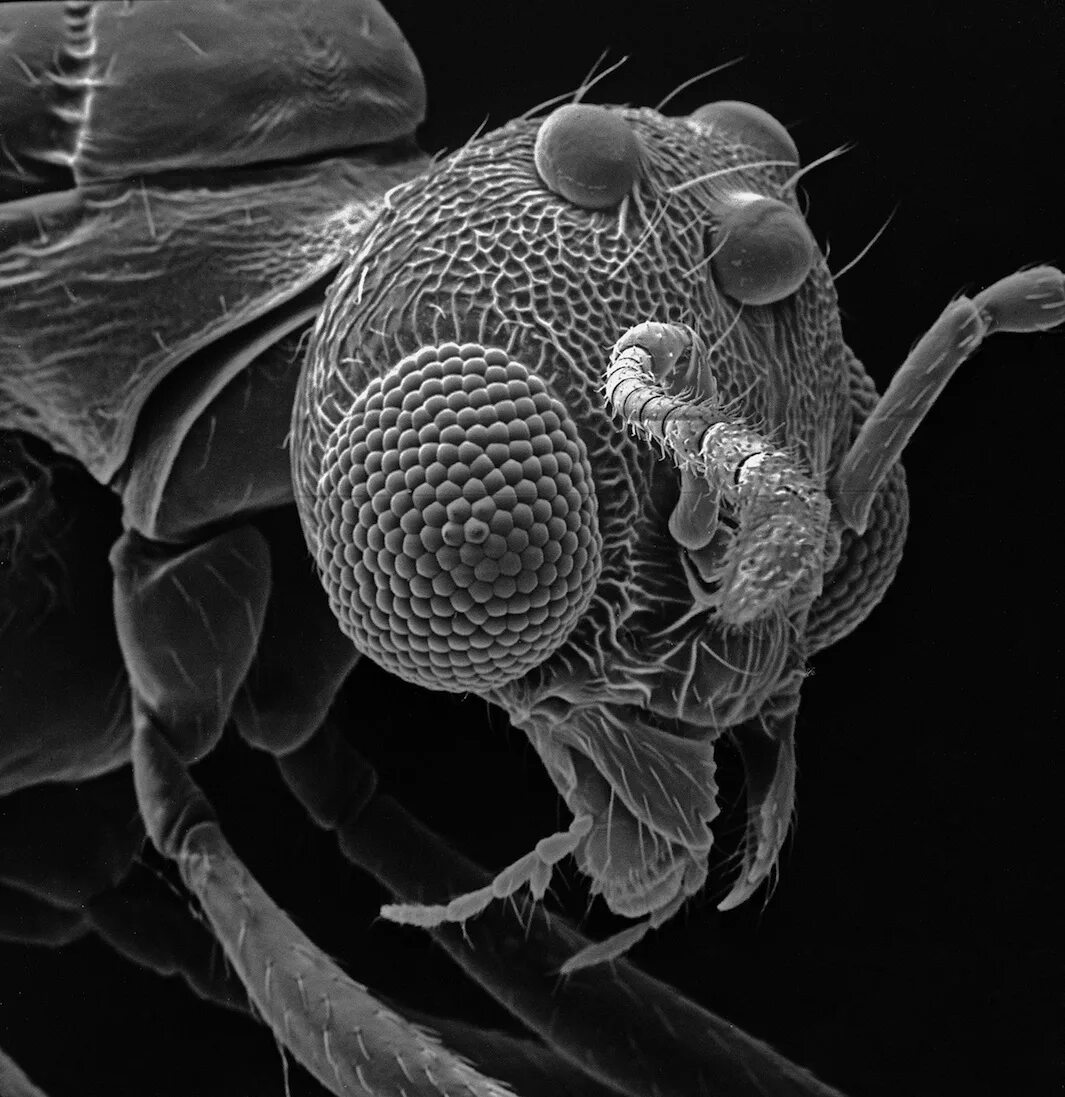 Бактерии на мухе. Скутигеры микрофотография. Клещ микрофотографии. Микромир насекомые под микроскопом. Микрофотографии бактерий под микроскопом.