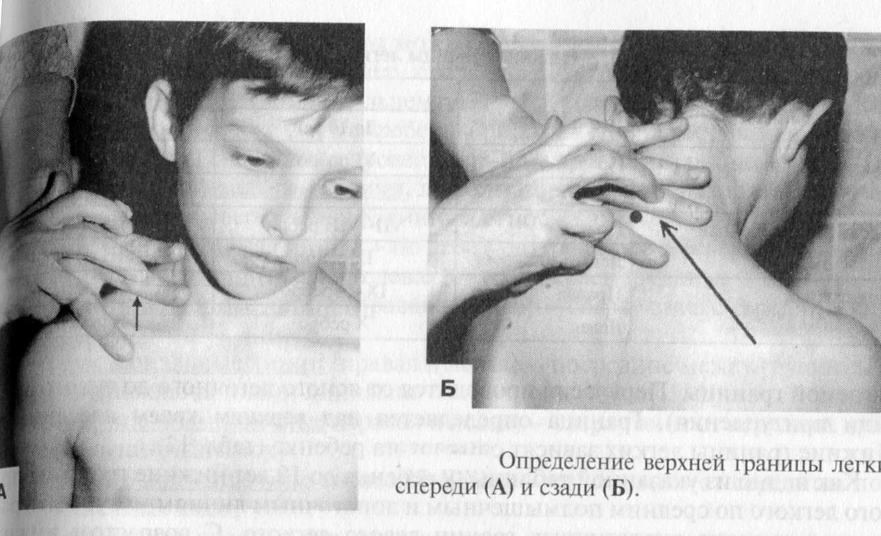 Ширина полей Кренига перкуссия. Методика определения поля Кренига. Измерения ширины полей Кренига. Ширина полей Кренига у детей. Стояние верхушек легких норма