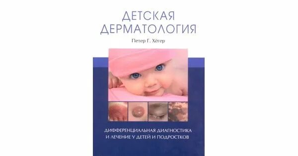 Детский дерматолог новочеркасск. Детская дерматология заславский. детская дерматология атлас с вейнберг. детская дерматология: руководство для врачей. горланов детская дерматовенерология.