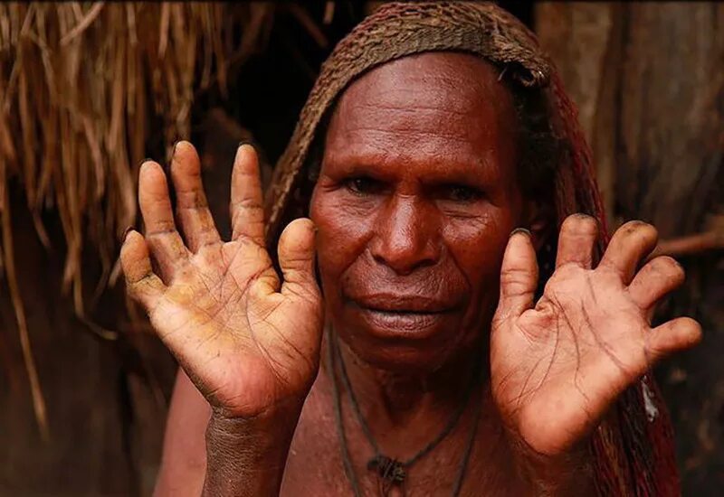 Племя новая Гвинея Дани Гвинея. Племена каннибалов новой Гвинеи. Папуа новая Гвинея женщины племени Дани. Картинки людоеда