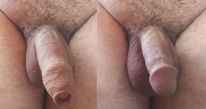 Затянулся Пенис