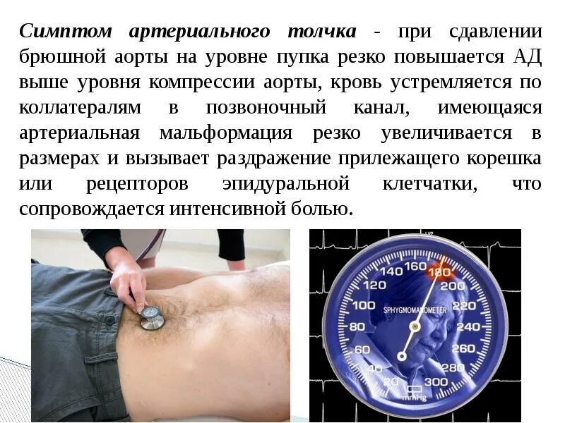 Симптом кашлевого толчка. Симптом артериального толчка. симптом кашлевого дочка. синдром кашлевого толчка при грыжах.
