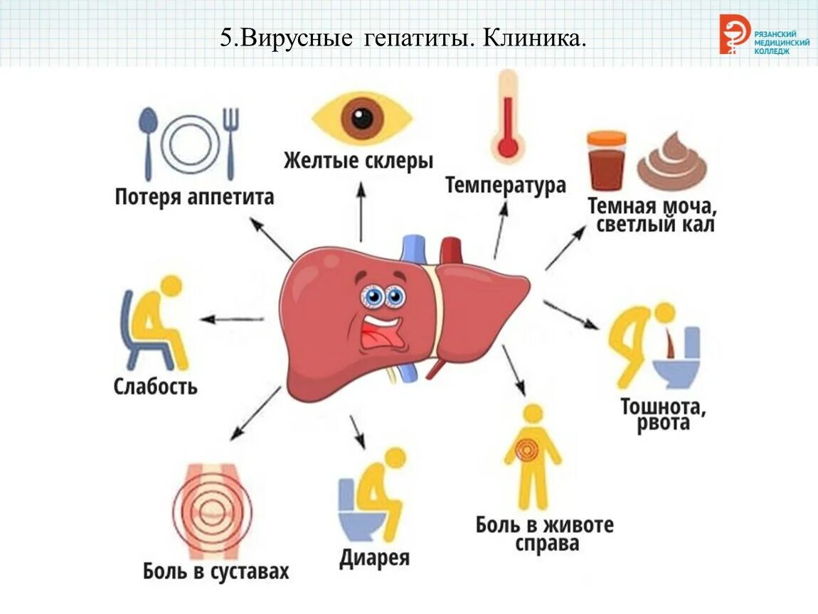 Причины заболевания гепатитом б. Основные клинические симптомы гепатита в. Основные клинические симптомы гепатита б. Болезнь печени гепатит б симптомы. Инфекция вирусного гепатита симптомы.