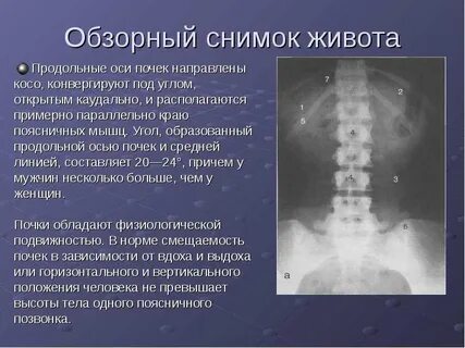 Кто снимок что это