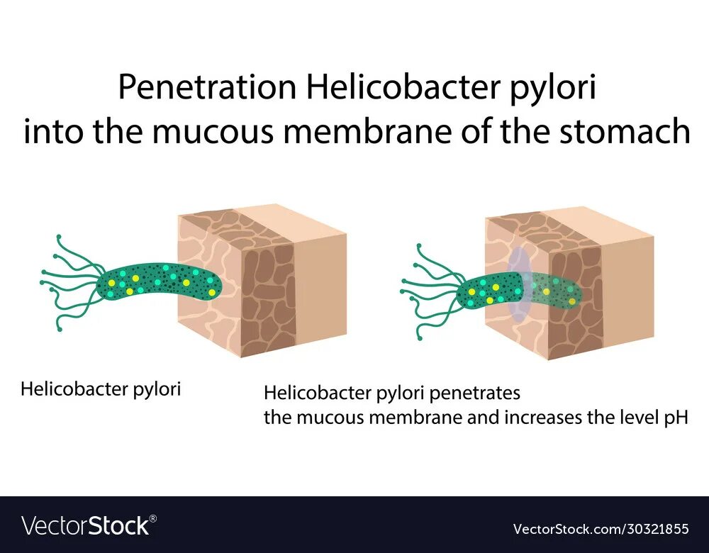 Как можно заразиться хеликобактер. Хеликобактер пилори Vektor. Заражение хеликобактер пилори. Хеликобактер пилори гистология. Helicobacter pylori микроскопия.