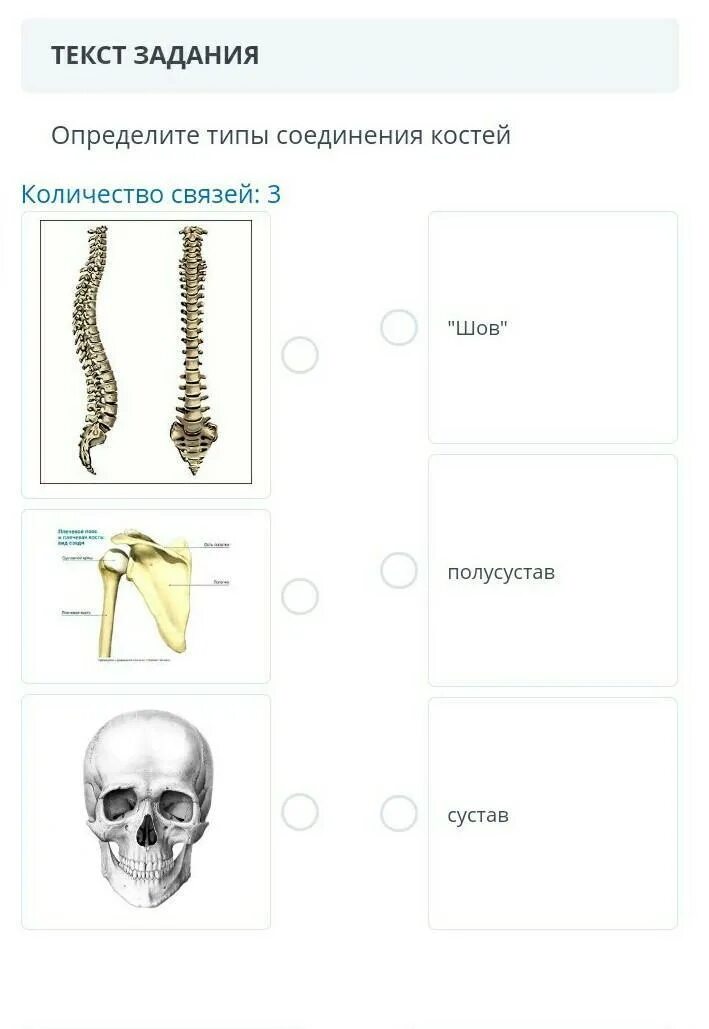 Типы соединения костей. Различают типы соединения костей. Типы соединение костей задание. Типы соединения костей с примерами.