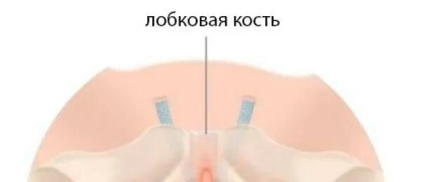 Секс Во Вренмя Месячных