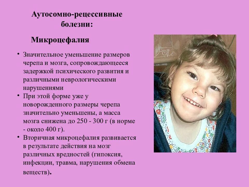 Аутосомно рецессивные заболевания. Аутосомно-рецессивные заболевания примеры. аутосомно-рецессивный з. рецессивные аутосомно заболевания у человека.