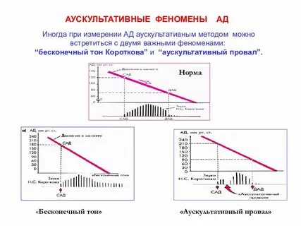 Метод тона
