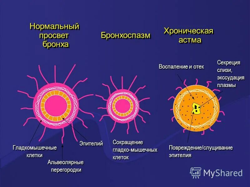 Клетки б укорачивание