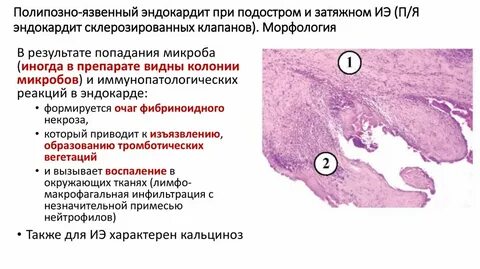 Препарат виден
