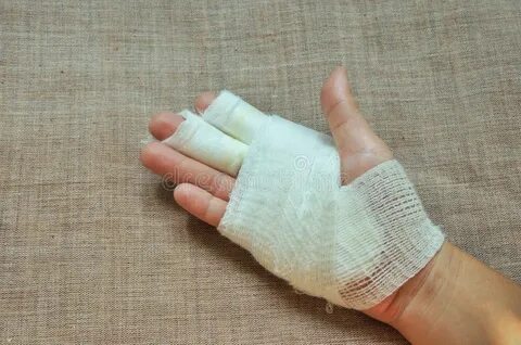 Как накладывать гипс на пальцы