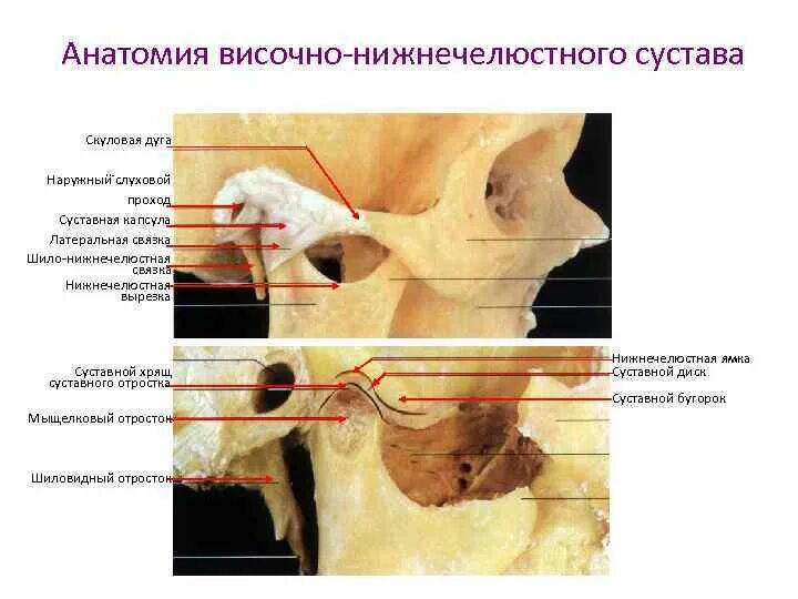 Соединение нижнечелюстной и височной кости. Связки височно-нижнечелюстного сустава анатомия. Верхнечелюстной сустав ВНЧС. Суставная ямка височно-нижнечелюстного сустава. Анатомия сустава ВНЧС.