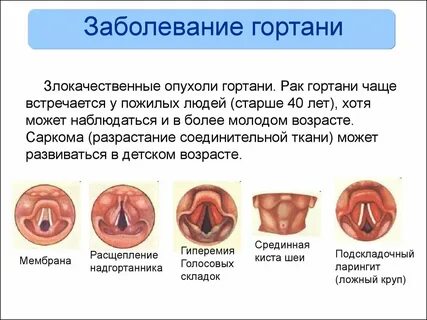 Диагноз голос