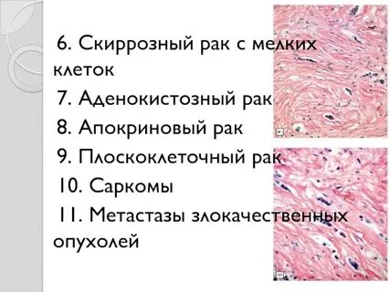 Рак 8 ноября