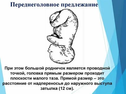 Головное переднее